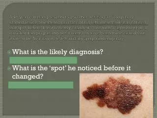 What is the likely diagnosis? Malignant melanoma