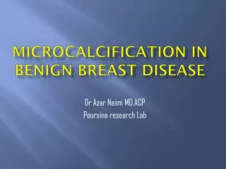 MICROCALCIFICATION IN BENIGN BREAST DISEASE