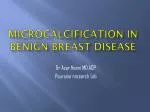 MICROCALCIFICATION IN BENIGN BREAST DISEASE - slide 1