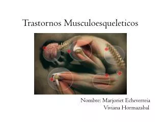 Trastornos Musculoesqueleticos