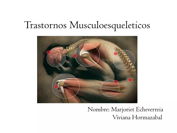 trastornos musculoesqueleticos