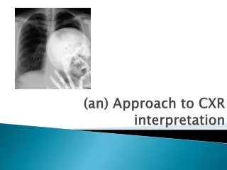 (an) Approach to CXR interpretation