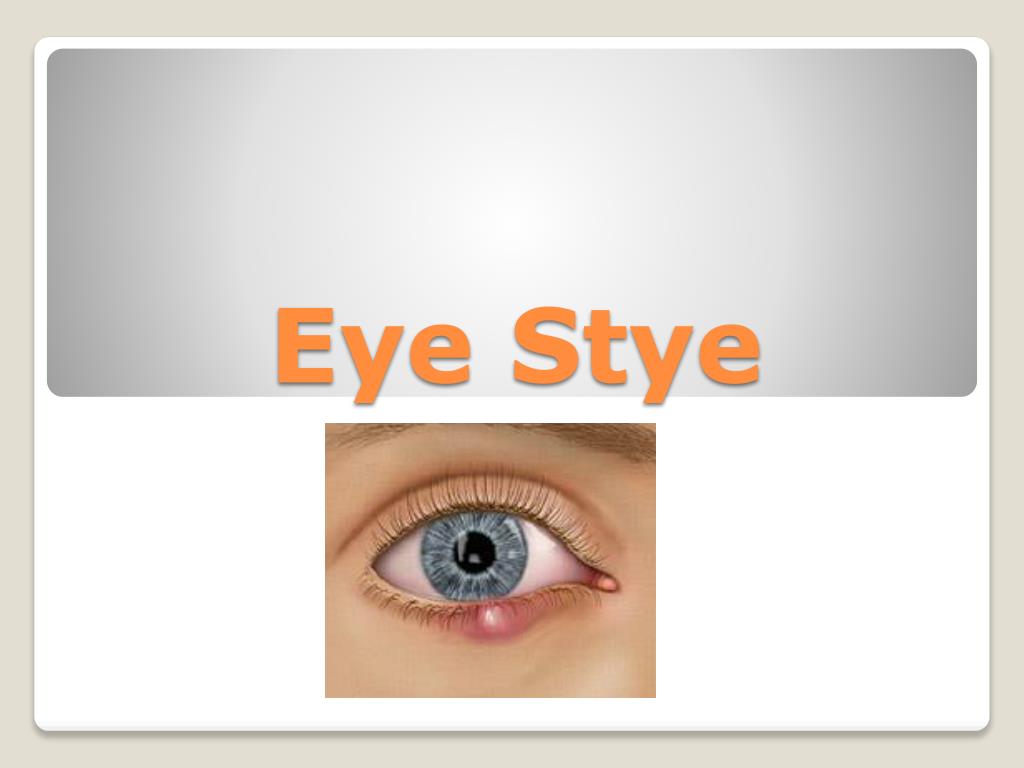 Stye Handout.pdf PPT - Eye Stye PowerPoint Presentation, free download - ID:2049097