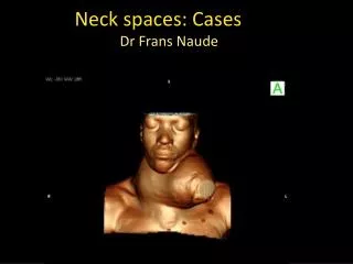 Neck spaces: Cases