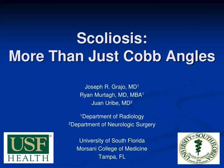 scoliosis more than just cobb angles