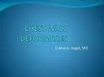 CHEST WALL DEFORMITIES - slide 1