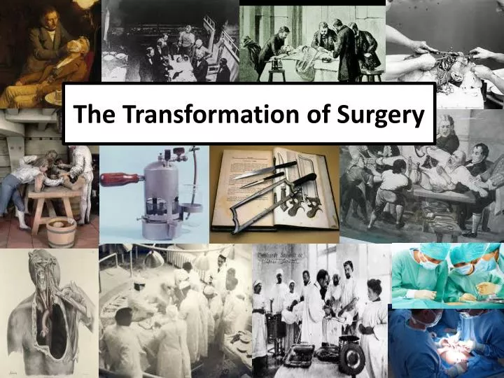 the transformation of surgery