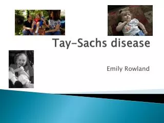 Tay -Sachs disease