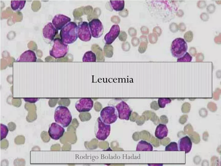 leucemia