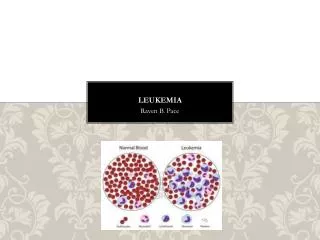 Leukemia