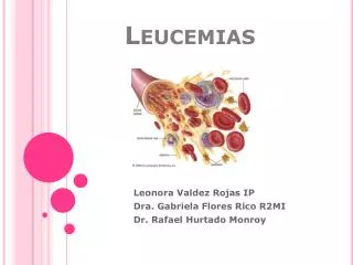 leucemias