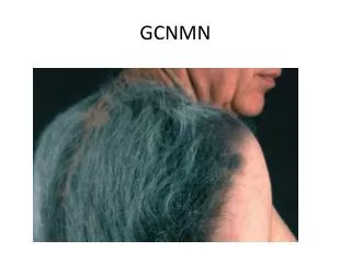 gcnmn