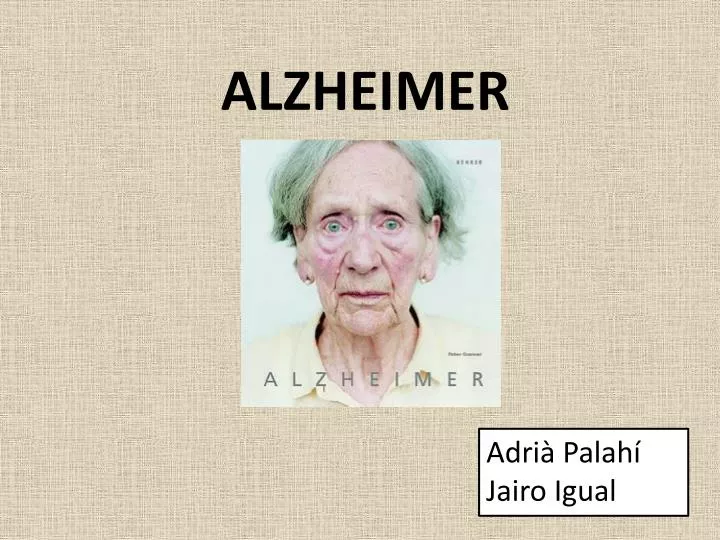alzheimer