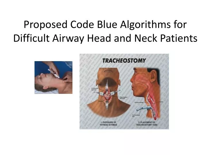 proposed code blue algorithms for difficult airway head and neck patients