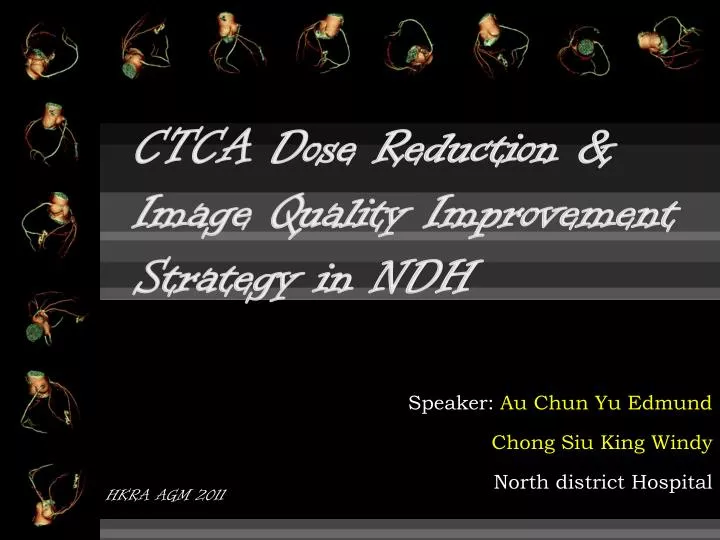 ctca dose reduction image quality improvement strategy in ndh