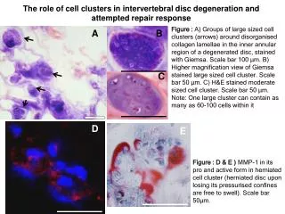 The role of cell clusters in intervertebral disc degeneration and attempted repair response