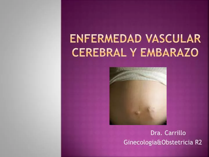 enfermedad vascular cerebral y embarazo