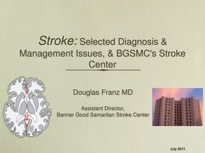 stroke selected diagnosis management issues bgsmc s stroke center