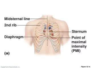 Figure 18.1a