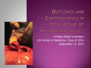 Outcomes and Controversies in fetal repair of myelomeningoceles