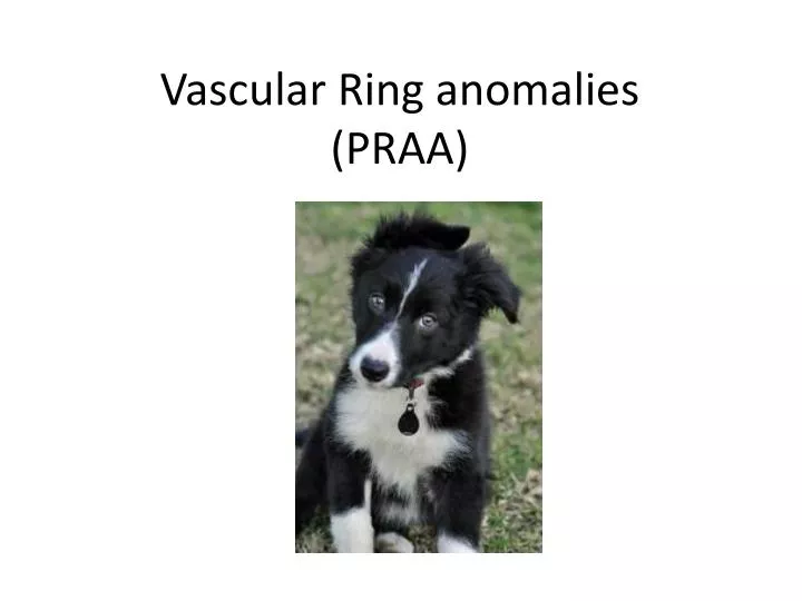 vascular ring anomalies praa