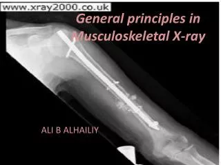 General principles in Musculoskeletal X-ray