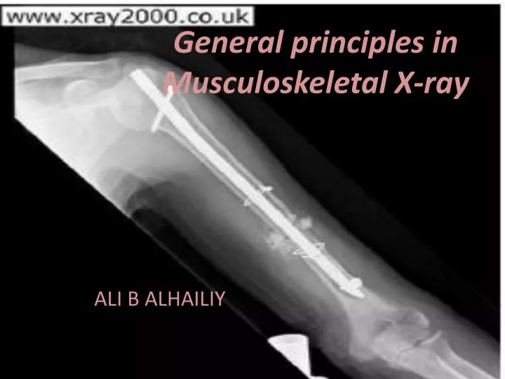 general principles in musculoskeletal x ray