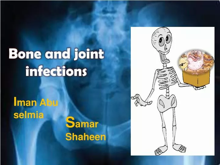 bone and joint infections