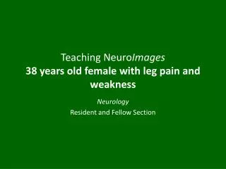 Teaching Neuro Images 38 years old female with leg pain and weakness