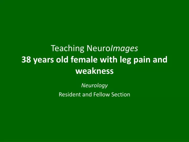 teaching neuro images 38 years old female with leg pain and weakness