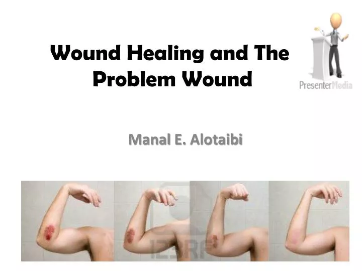 wound healing and the problem wound