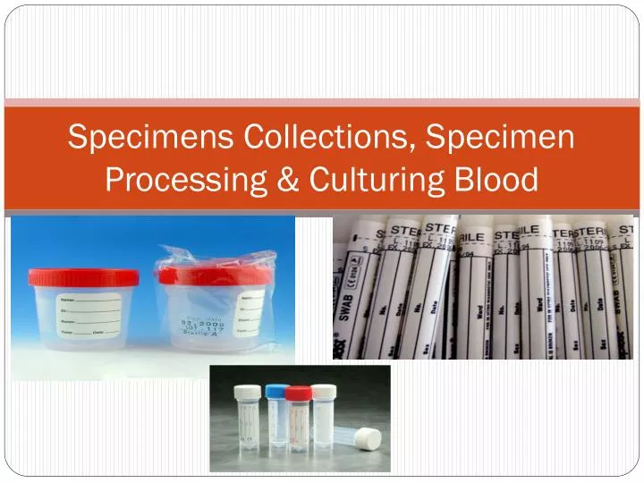 specimens collections specimen processing culturing blood