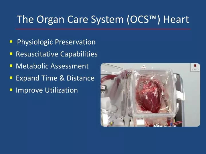 the organ care system ocs heart