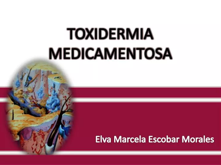 toxidermia medicamentosa