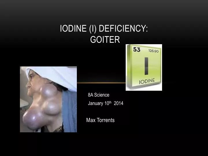 iodine i deficiency goiter