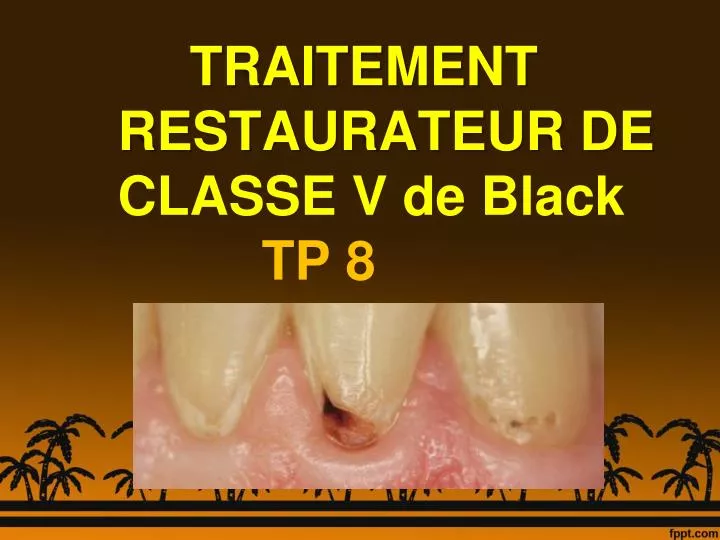 traitement restaurateur de classe v de black tp 8