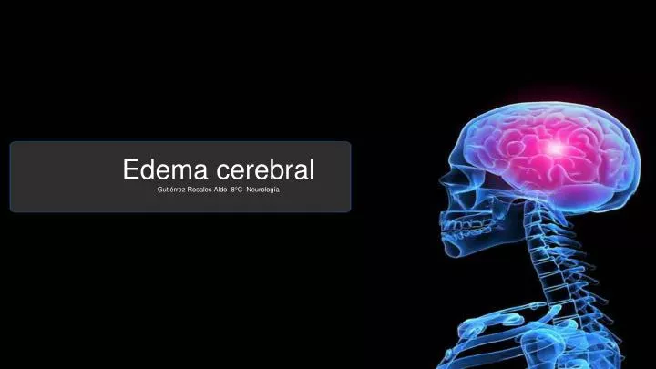 edema cerebral guti rrez rosales aldo 8 c neurolog a