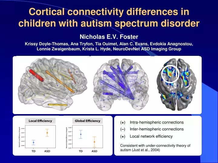 cortical connectivity differences in children with autism spectrum disorder
