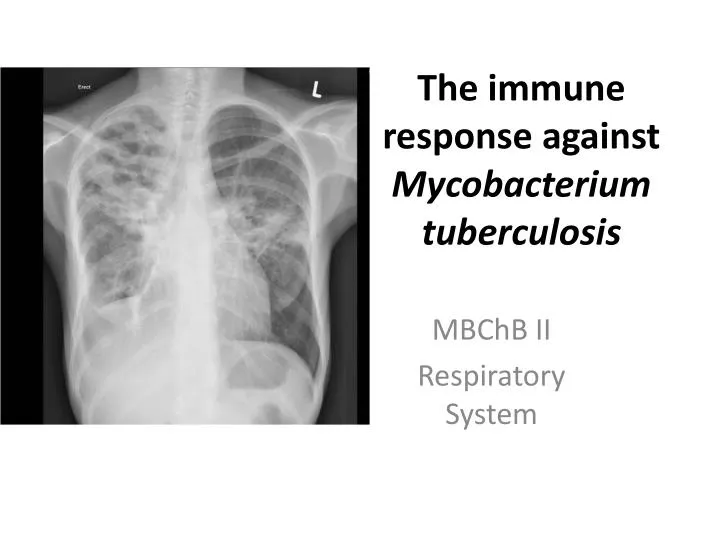 the immune response against mycobacterium tuberculosis