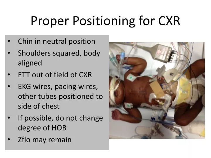 proper positioning for cxr