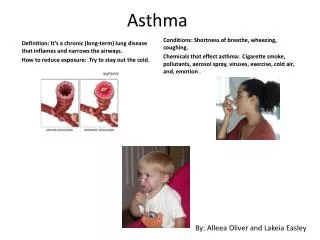 Asthma