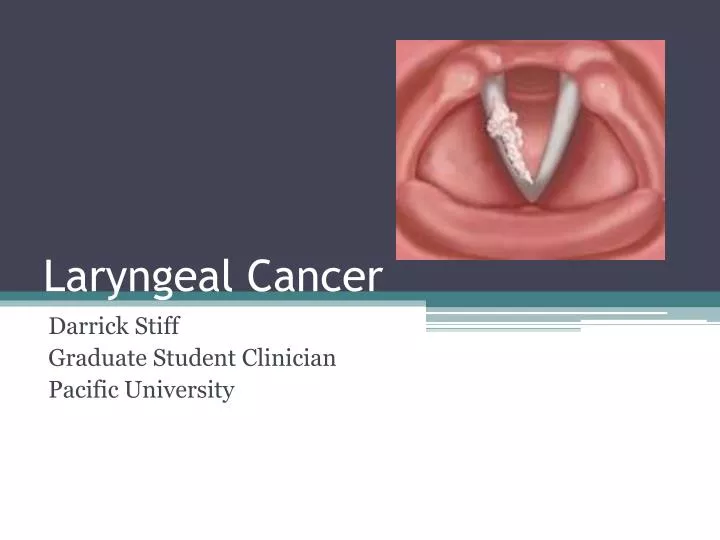 laryngeal cancer