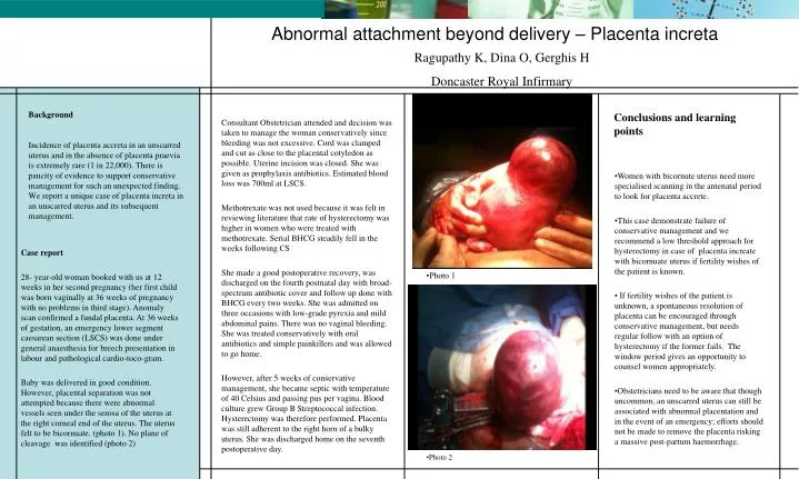 abnormal attachment beyond delivery placenta increta