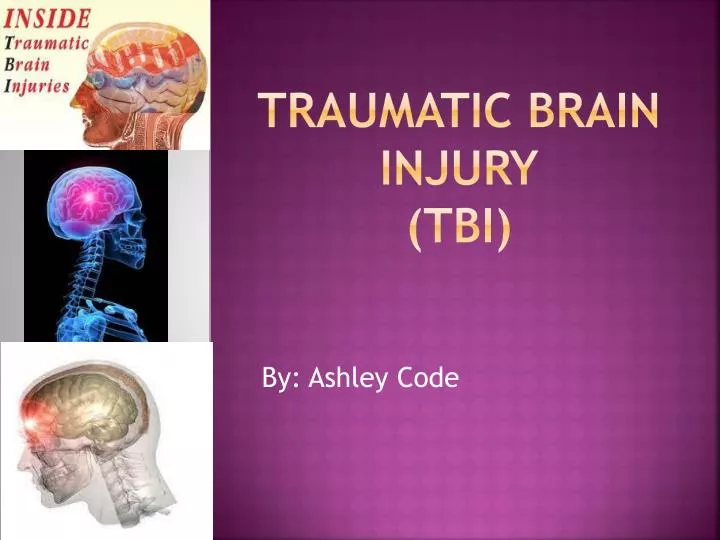 traumatic brain injury tbi