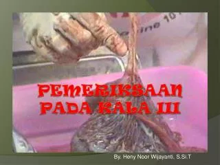 pemeriksaan pada kala iii