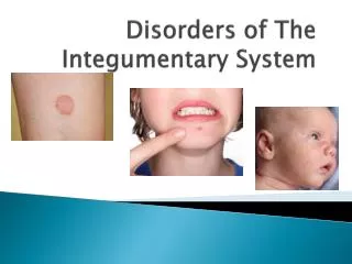 Disorders of The Integumentary System