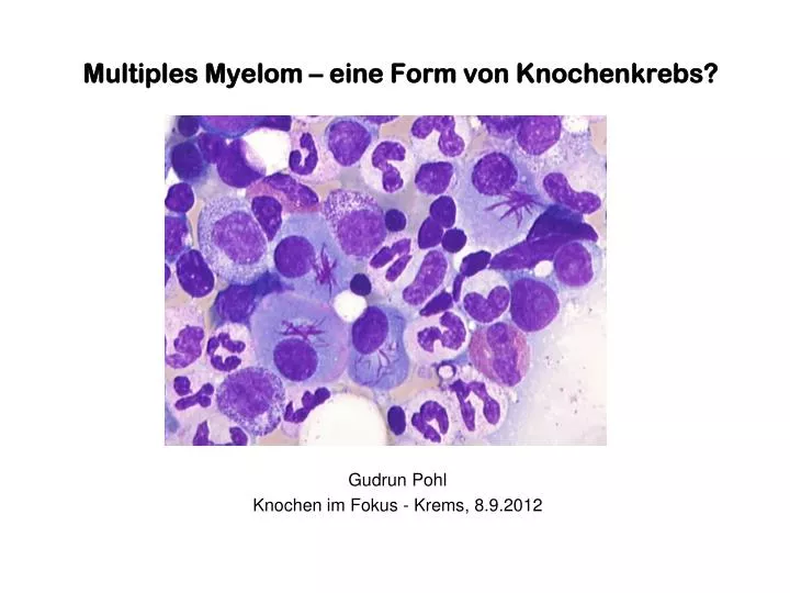 multiples myelom eine form von knochenkrebs