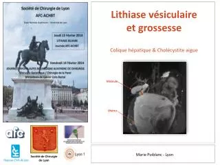 marie poiblanc lyon