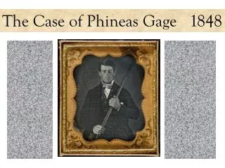 The Case of Phineas Gage 1848