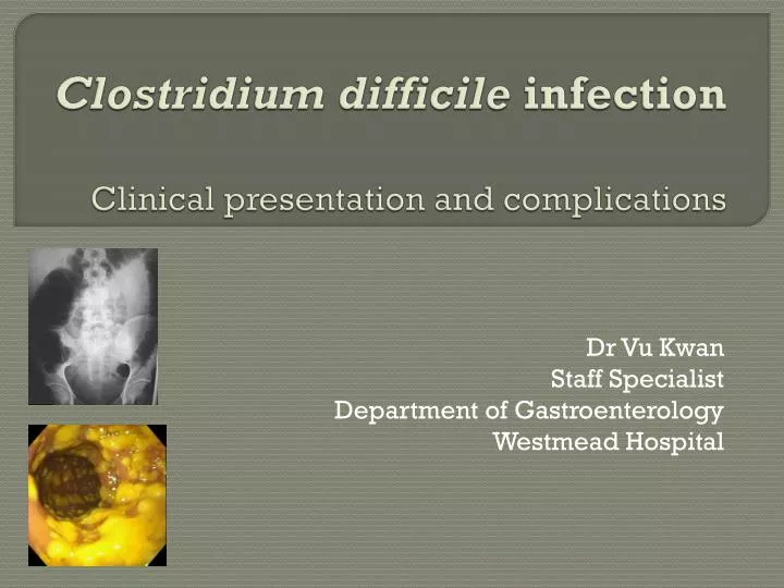 clostridium difficile infection clinical presentation and complications